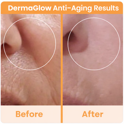 DermaGlow Pro High Frequency Wand